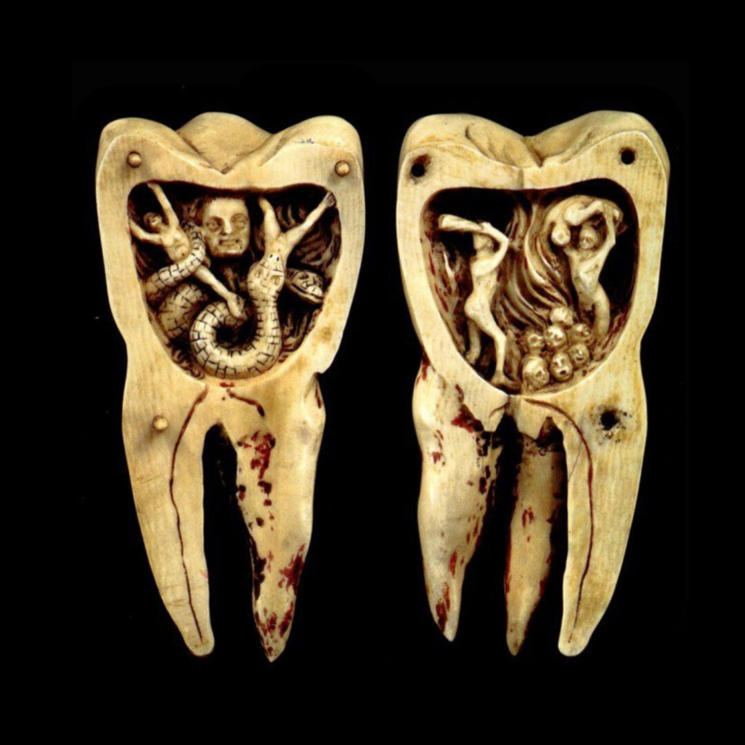 Шүдэн дотор хорхой үнэхээр байдаг уу? зураг